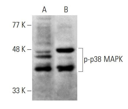 fujisusakiページ p-p38 MAPK抗体(E-1) | SCBT - Santa Cruz Biotechnology