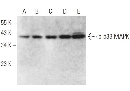 p-p38 MAPK Antibody (E-1) | SCBT - Santa Cruz Biotechnology