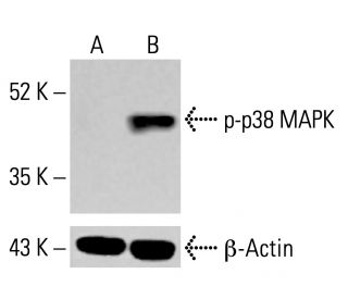 p-p38 MAPK抗体(E-1) | SCBT - Santa Cruz Biotechnology