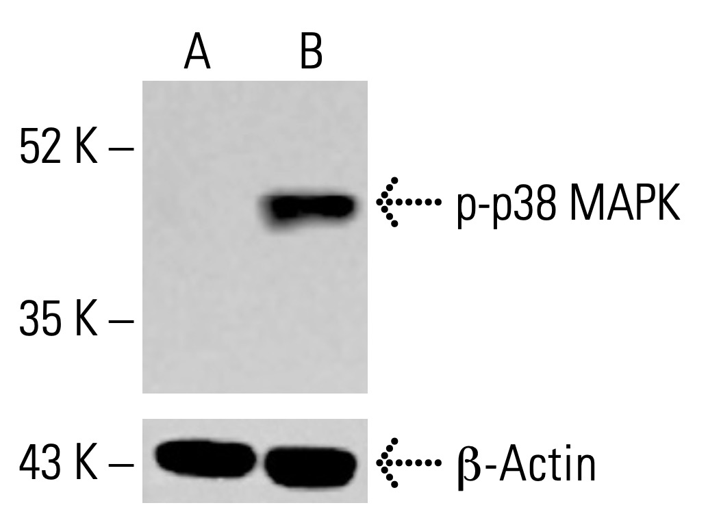 p-p38 MAPK抗体(E-1) | SCBT - Santa Cruz Biotechnology