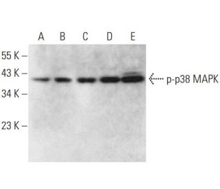 western blotting image from recommended p-p38 MAPK (E-1) monoclonal antibody replacement. Image 376459