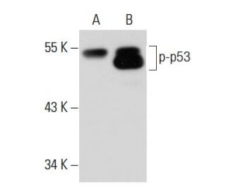 p-p53 Antibody (3H2806) - Western Blotting - Image 48945