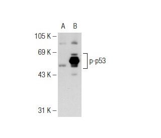 p-p53 Antibody (59.Ser 315) - Western Blotting - Image 126516 