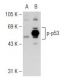 p-p53 Antibody (59.Ser 315) - Western Blotting - Image 126516 