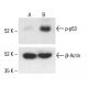 p-p53 Antibody (59.Ser 315) - Western Blotting - Image 411295