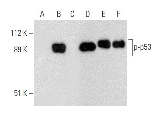 Anti P P53 Antibody B 12 Scbt Santa Cruz Biotechnology