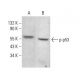 p-p53 Antibody (B-12) - Western Blotting - Image 383054