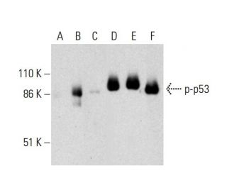 p-p53 Antibody (B-3) - Western Blotting - Image 289902 