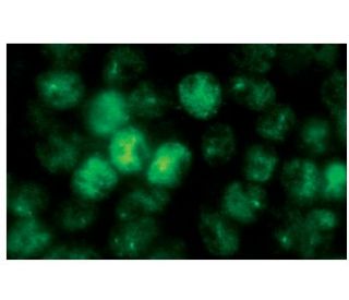 p-p53 Antibody (FP3.2) - Immunofluorescence - Image 48433 