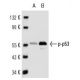p-p53 Antibody (FP3.2) - Western Blotting - Image 14105 