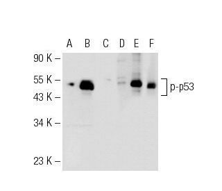 p-p53 Antibody (FPS392) - Western Blotting - Image 72002