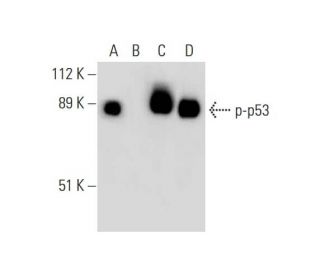 western blotting image from recommended p-p53 (F-11) monoclonal antibody replacement. Image 296061