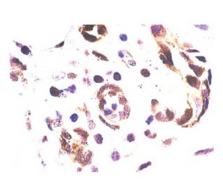 p-p70 S6 kinase/S6K1 Antibody (A-6) | SCBT - Santa Cruz p-p70 S6 kinase/S6K1 Antibody (A-6) | SCBT - Santa Cruz
