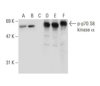 p-p70 S6 kinase/S6K1 Antibody (A-6) - Western Blotting - Image 133467 