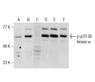 western blotting image from recommended p-p70 S6 kinase/S6K1 (E-5) monoclonal antibody replacement. Image 160937