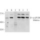 western blotting image from recommended p-p70 S6 kinase/S6K1 (E-5) monoclonal antibody replacement. Image 160937