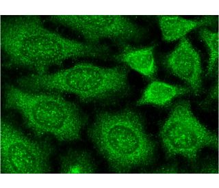 immunofluorescence image from recommended p-paxillin (A-5) monoclonal antibody replacement. Image 145166