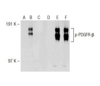 Anti P Pdgf Receptor Beta Pdgfr B Antibody H 3 Scbt Santa Cruz Biotechnology