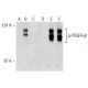 p-PDGF Receptor beta/PDGFRB Antibody (H-3) - Western Blotting - Image 141670 