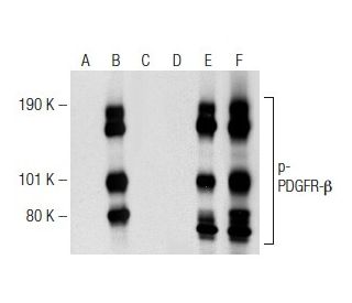 Anti P Pdgf Receptor Beta Pdgfr B Antibody H 8 Scbt Santa Cruz Biotechnology