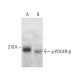 p-PDGF Receptor beta/PDGFRB Antibody (H-8) - Western Blotting - Image 375367 