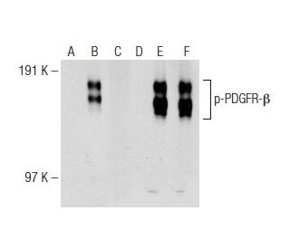 western blotting image from recommended p-PDGF Receptor beta/PDGFRB (F-10) monoclonal antibody replacement. Image 141665