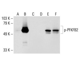 p-PFK-2/PFKFB2 Antibody (B-3) - Western Blotting - Image 148880