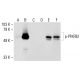 p-PFK-2/PFKFB2 Antibody (B-3) - Western Blotting - Image 148880