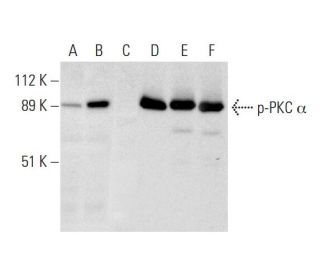 western blotting image from recommended p-PKC alpha (A-11) monoclonal antibody replacement. Image 297896
