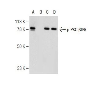 western blotting image from recommended p-PKC beta 2/delta (E-7) monoclonal antibody replacement. Image 141605