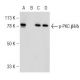 western blotting image from recommended p-PKC beta 2/delta (E-7) monoclonal antibody replacement. Image 141605