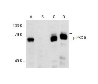 western blotting image from recommended p-PKC delta (F-7) monoclonal antibody replacement. Image 145794