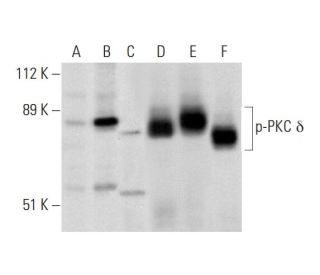western blotting image from recommended p-PKC delta (A-8) monoclonal antibody replacement. Image 296057