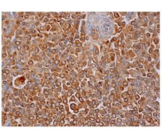 p-PKC theta Antibody (A-11) - Immunohistochemistry - Image 285731 