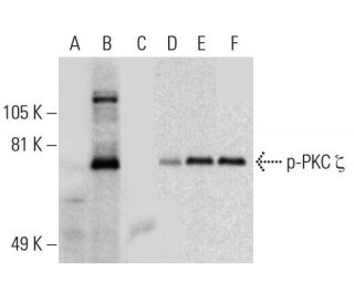 western blotting image from recommended p-PKC zeta (H-2) monoclonal antibody replacement. Image 136714