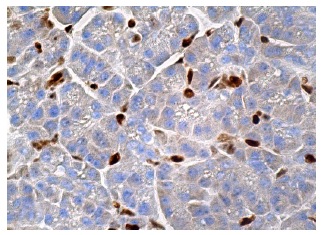 p-PP2A-Cα/β Antibody (F-8) | SCBT - Santa Cruz Biotechnology