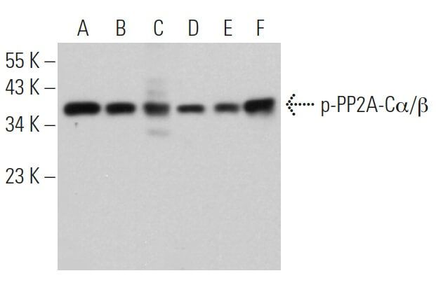 Anti P Pp2a Ca B Antibody F 8 Scbt Santa Cruz Biotechnology