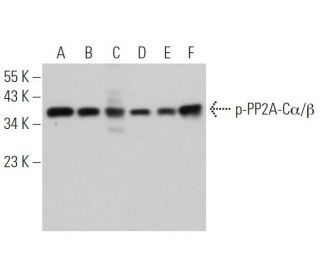 western blotting image from recommended p-PP2A-C&alpha;/&beta; (F-8) monoclonal antibody replacement. Image 373426