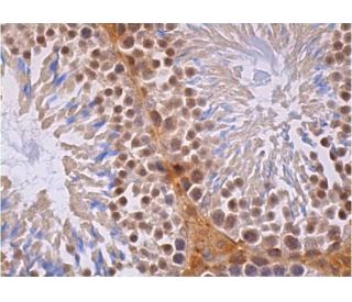 immunohistochemistry image from recommended p-PRC1 (C-2) monoclonal antibody replacement. Image 384120