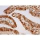 p-PYK2 Antibody (13.Tyr 402) - Immunohistochemistry - Image 383410