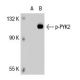p-PYK2 Antibody (14F6) - Western Blotting - Image 37071