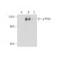 p-PYK2 Antibody (14F6) - Western Blotting - Image 60121 