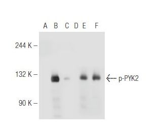p-PYK2 Antibody (14F6) - Western Blotting - Image 81113 