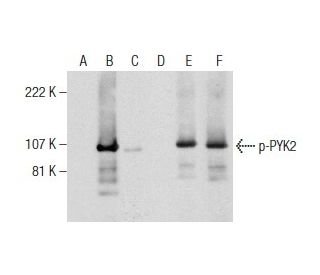 western blotting image from recommended p-PYK2 (13.Tyr 402) monoclonal antibody replacement. Image 159777