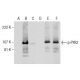 Este anticuerpo policlonal ha dejado de fabricarse. Consulta nuestro anticuerpo monoclonal recomendado <a href="p-pyk2-antibody-13-tyr-402">p-PYK2 (13.Tyr 402)</a> (se muestran datos de muestra). western blotting image from recommended p-PYK2 (13.Tyr 402) monoclonal antibody replacement. Image 159777