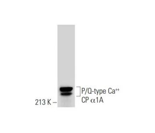 P/Q-type Ca<sup>++</sup> CP α1A Antibody (C-2) - Western Blotting - Image 297430