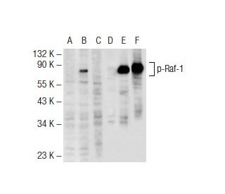 p-Raf-1 Antibody (6B4) - Western Blotting - Image 72021 