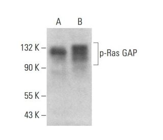 p-Ras GAP Antibody (pY460.19A) - Western Blotting - Image 380748 
