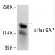 p-Ras GAP Antibody (pY460.19A) - Western Blotting - Image 413453