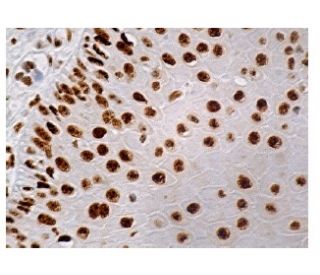 p-Rb Antibody (E-10) | SCBT - Santa Cruz Biotechnology